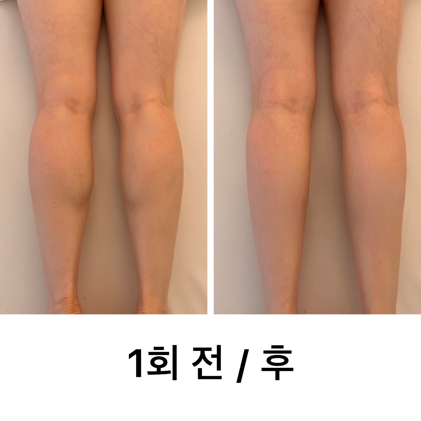 KakaoTalk_20240710_162032134_05.jpg