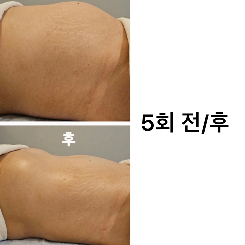 바디슬리밍