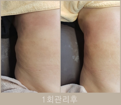 바디슬리밍