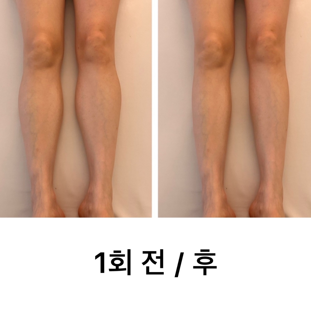바디슬리밍