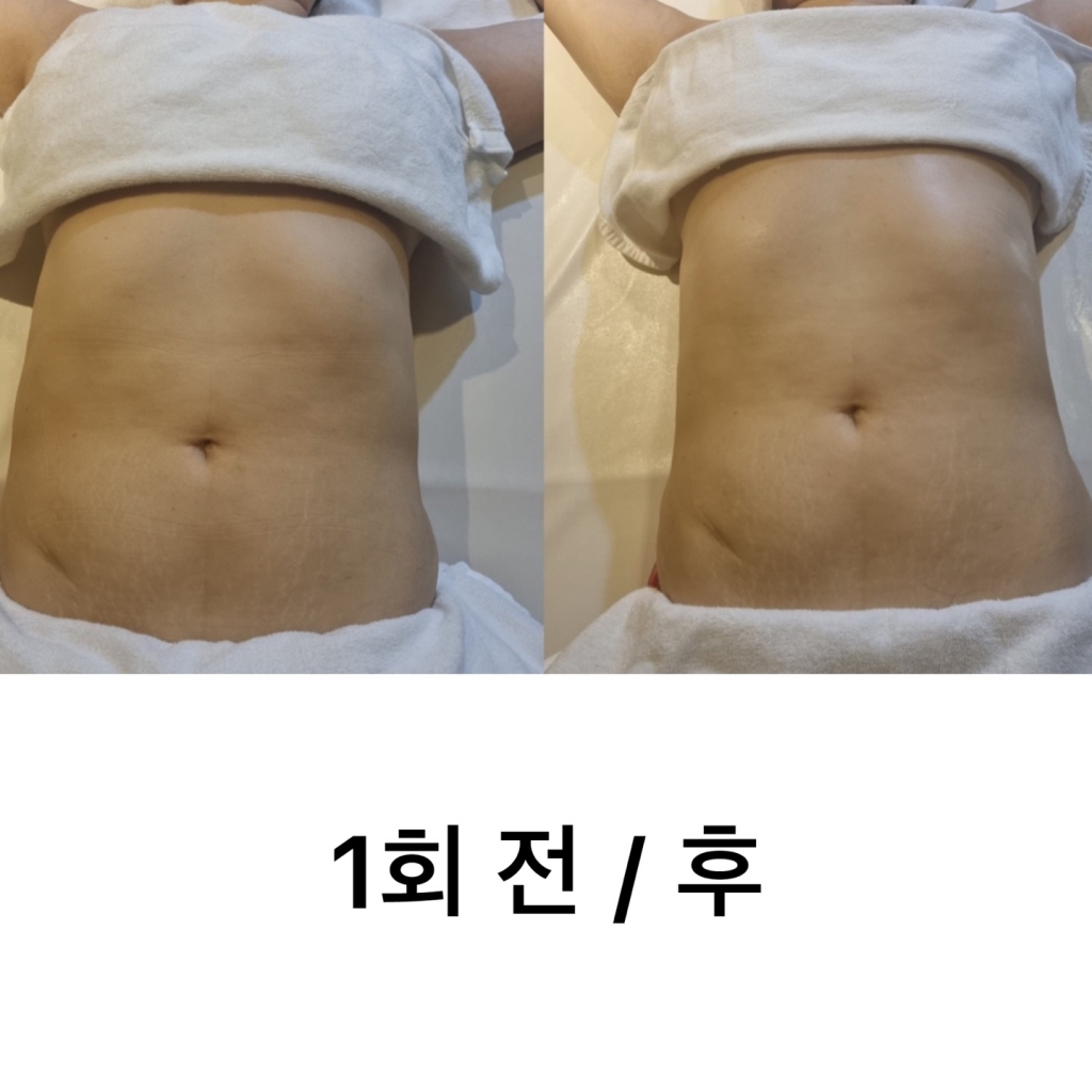 바디슬리밍