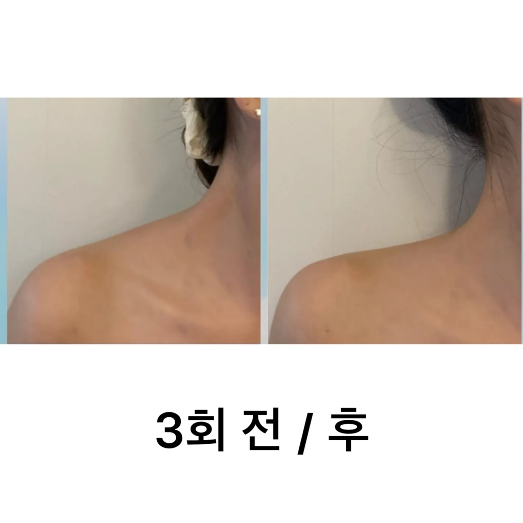 바디슬리밍