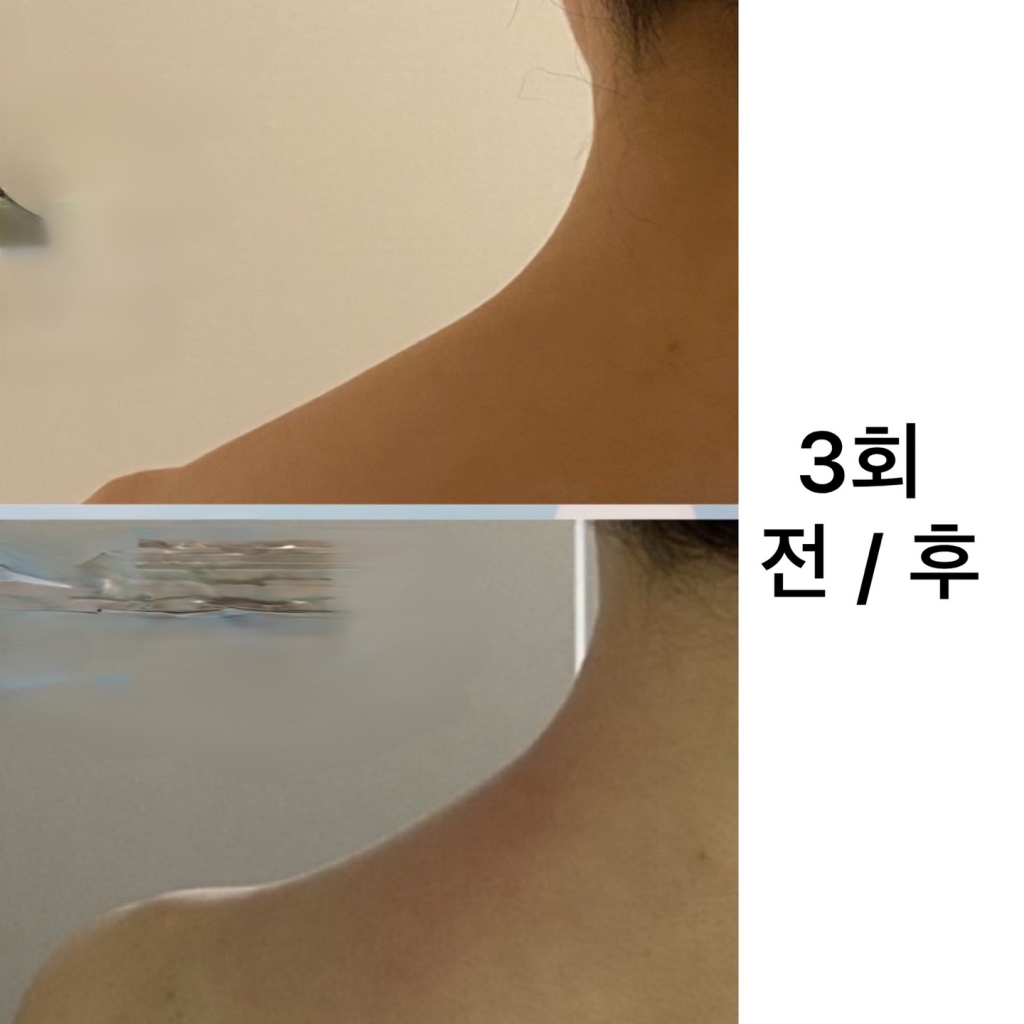 바디슬리밍